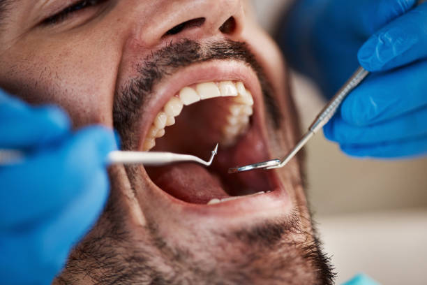 Best After-Hours Dental Trauma Care in Pomeroy, OH